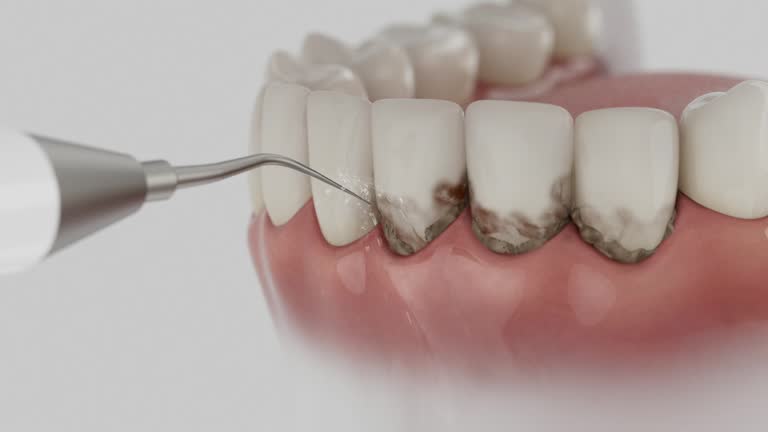 Reliable Dental Implants contractor in Oildale, CA by Smile Center Dentistry
